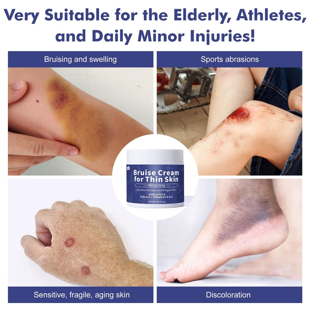 bruise-cream-extra-strength-fast-healing-4.jpg