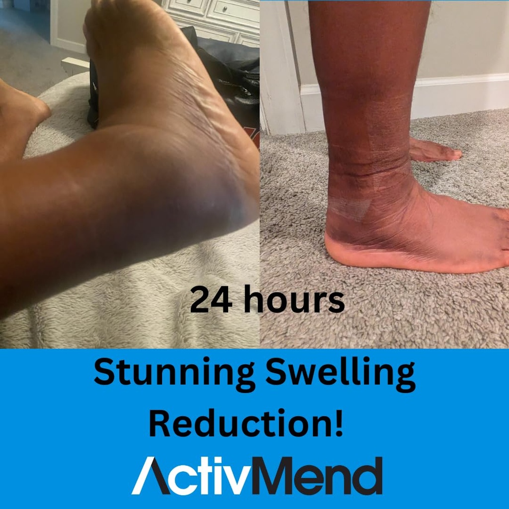 ankle-sprain-recovery-patches-helps-spee-6.jpg