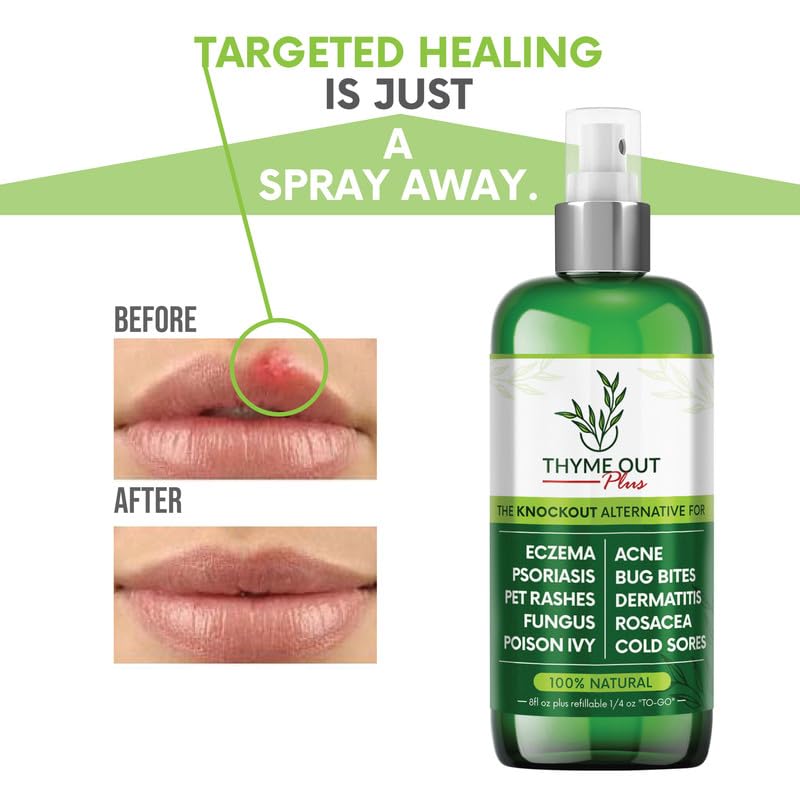 thyme-out-plus-eczema-treatment-psoriasi-6.jpg