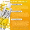 antifungal-psoriasis-shampoo-eczema-sebo-5.jpg