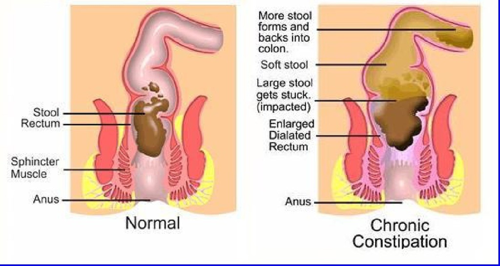 the-one-minute-miracle-miracle-oxy-colon-6.jpg