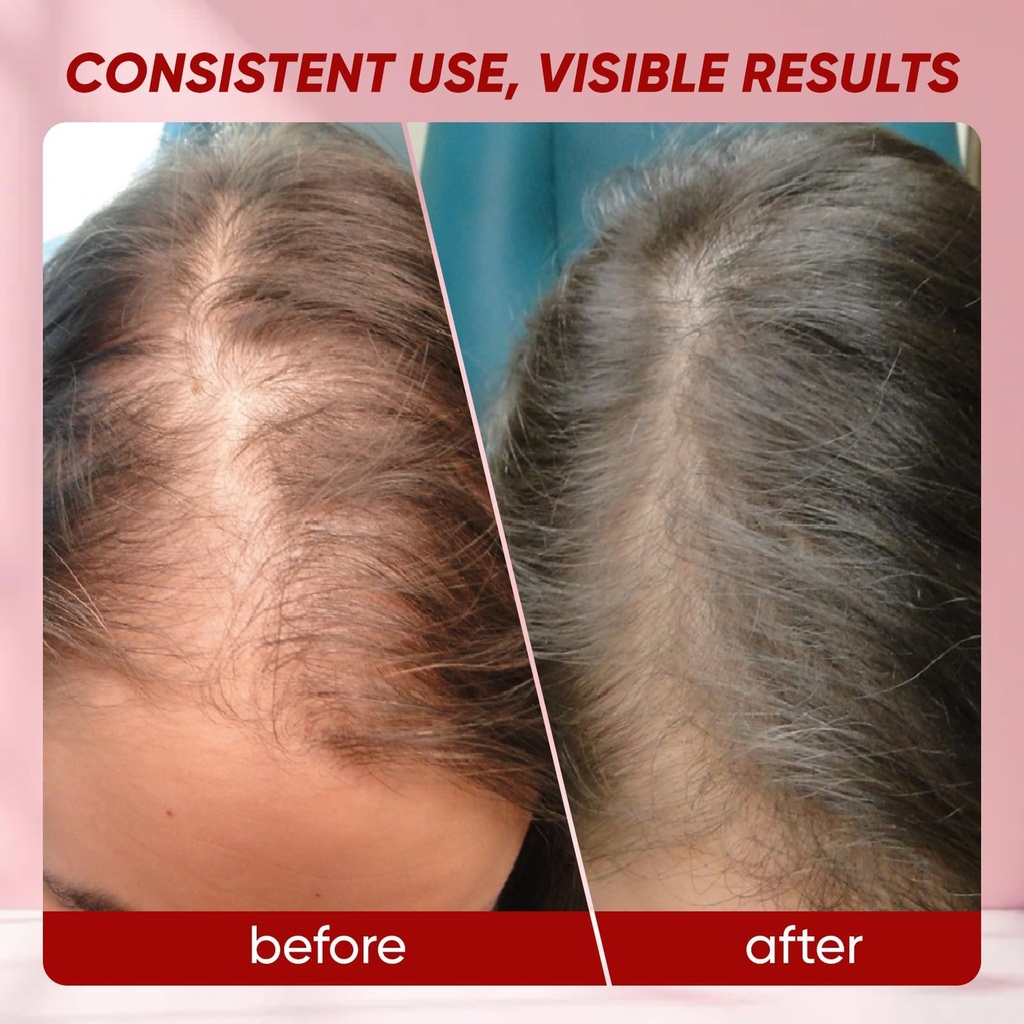 hair-growth-gummies-for-black-women-hair-6.jpg