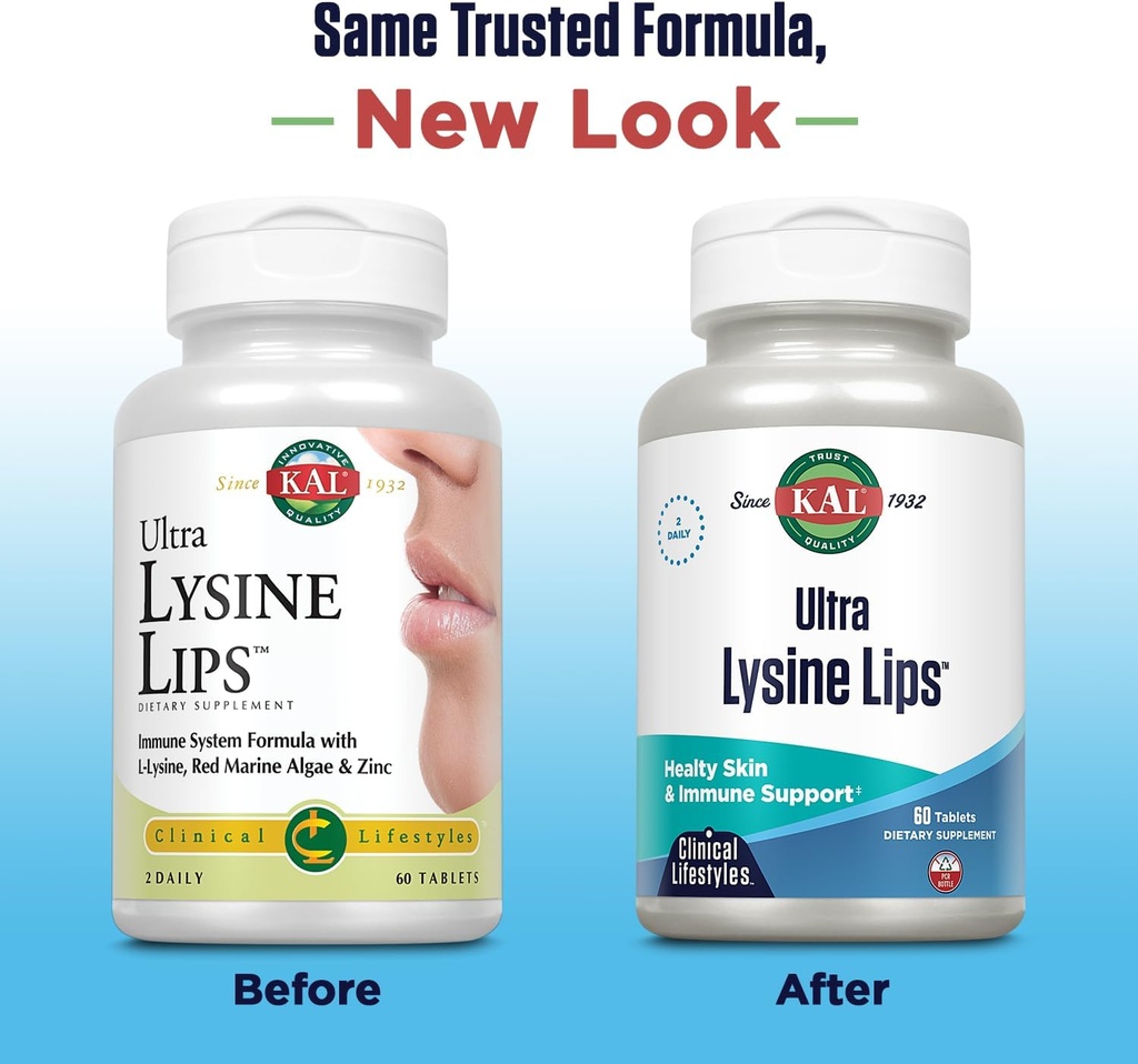 kal-ultra-lysine-lips-tablets-60-count-2.jpg