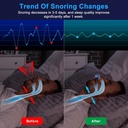 anti-snoring-device-mini-sleepapnea-devi-3.jpg