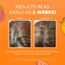 maryruth-s-multivitamin-hair-growth-gumm-3.jpg