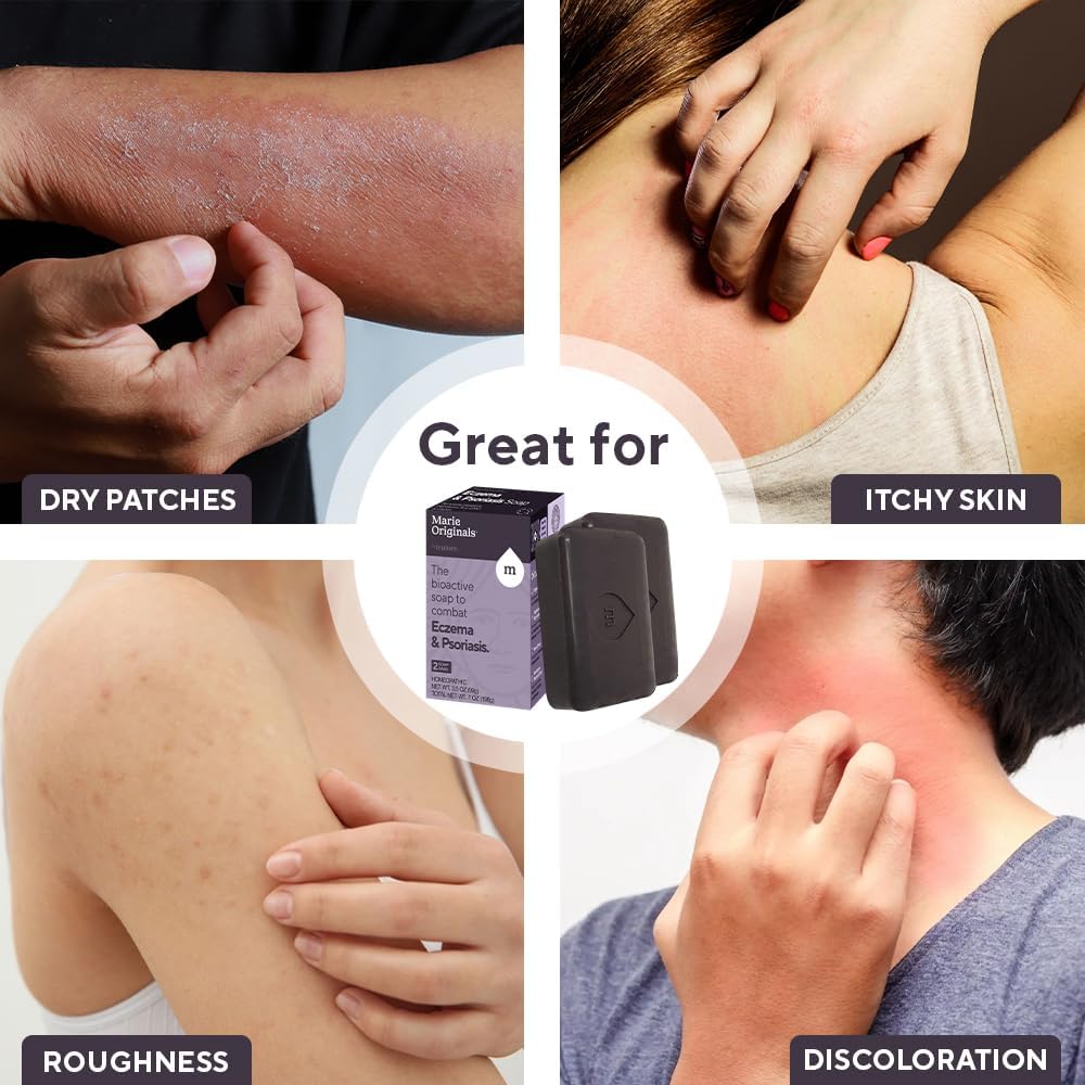 marie-originals-eczema-face-soap-body-wa-4.jpg