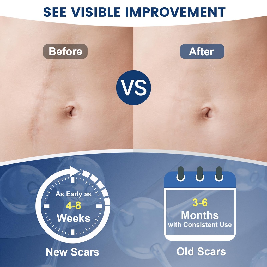 rvlaim-100-silicone-scar-gel-scar-cream--4.jpg