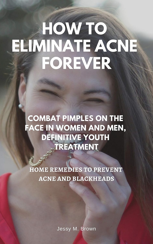 CÓMO ELIMINAR ACNE FOREVER : PIMPLES COMBAT sobre la cara en las mujeres y los hombres, DEFINITIVE JUVENILE TREATMENT, INICIO REMEDIES to PREVENT ACNE AND BLACKHEADS