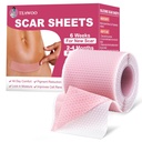 Hojas de cicatrices de silicona,Tapa de cicatrices siliconas para cicatrices quirúrgicas,C-Sección,Turquía de estómago,Retirada de bombas , Tapa facial para arrugas durante la noche (1.6"X 59" Roll-1.5M-Pigment Reduction-Pink)
