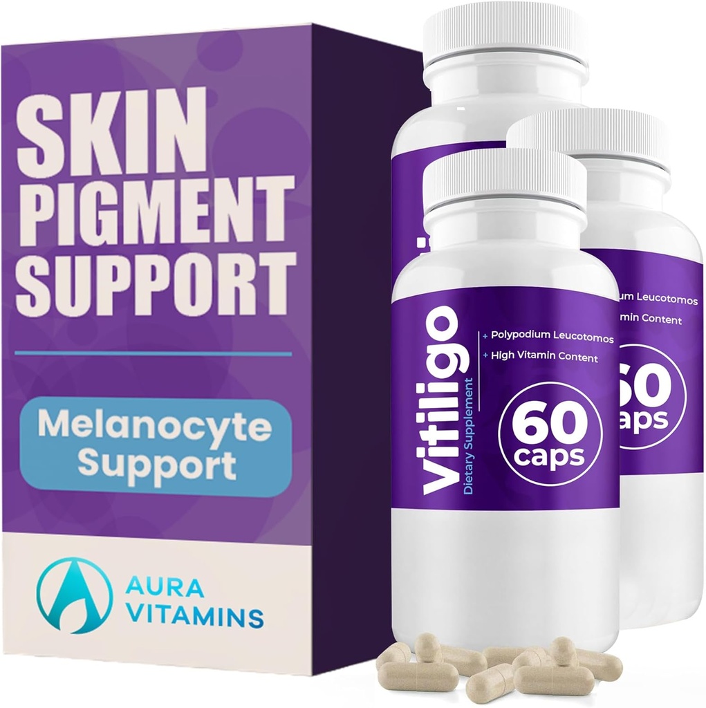 Vitiligo Capsules 60 Conteo TENIDO 1 Mes TENIDO Mejorar la Pigmentación de la Pigmentación de la Esquía Soporte y reducir manchas blancas TENIDO Eficaz Vitiligo Suplemento TENIDO Solución natural para manchas blancas en la piel. (3)