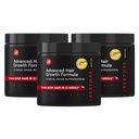 iRestore Advanced Hair Growth Supplement for Women, Hair Vitamins for Faster Hair Regrowth, Best for Hair Loss and Thinning - 1 Month Supply Cada - 30 Cuenta (Pack of 3) - Negro