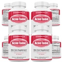 Píldoras de acné Suplemento- Vitaminas de piel clara Píldora para el tratamiento de la piel oleaginosa, Blemishes hormonales, Anti Spots &amp; Cystic Acnes Suplementos para mujeres, hombres, adolescentes &amp; adultos- 240 Tabletas orales