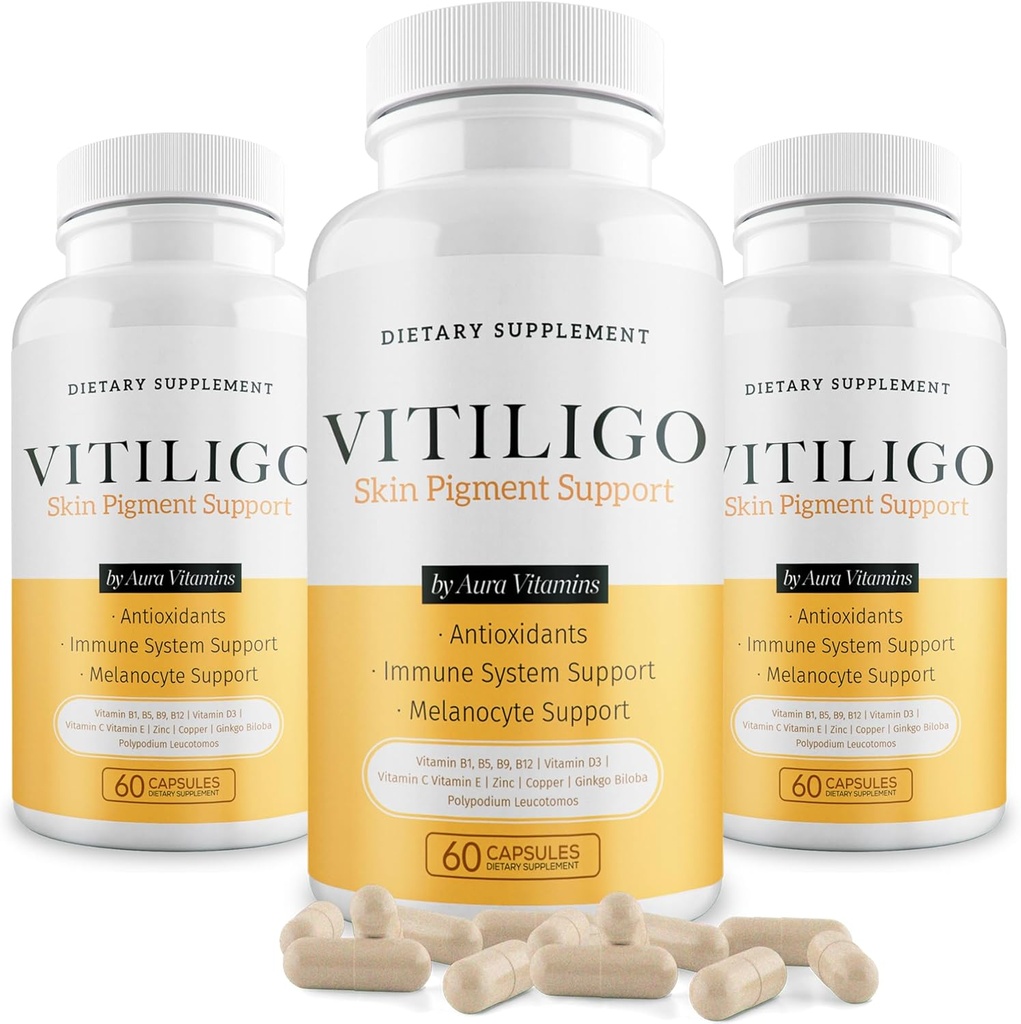 Dermawonder Vitiligo Capsules 60 Conde TENIDO Eficaz Vitiligo Suplemento TENIDO Reducir manchas blancas y mejorar la Pigmentación de la piel Apoyo TENIDO Apto para toda la piel ANTE Solución natural para manchas blancas en (3)