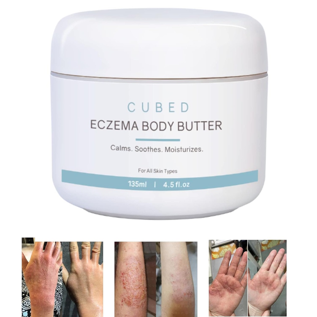 Cubed 4.5 oz Eczema Cream for Adults, Eczema Relief, Eczema Treatment, Moisturize Dry Irridated Skin, Smart Lotion for Topical Steroid Withdrawal Symptoms, Psoriasis & Rosacea, Eczema, Dermatitis