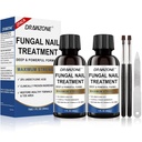 Tratamiento Toenail Fungus Extra Fuerza con 25% Ácido Undecilénico, Tratamiento de uñas, reparación de uñas, Tratamiento de uñas Fungus, uña amarilla, uñas dañadas Tratamiento de hongos extra fuerza