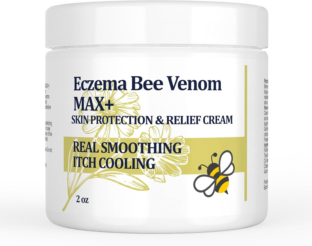 Crema de Venom de abeja de alta resistencia, ungüento de Eczema Dyshidrotic, picazón de calor, picazón, eczema, psoriasis, pierna, estómago, pie, mano, piel irritada, todo cuidado de la edad