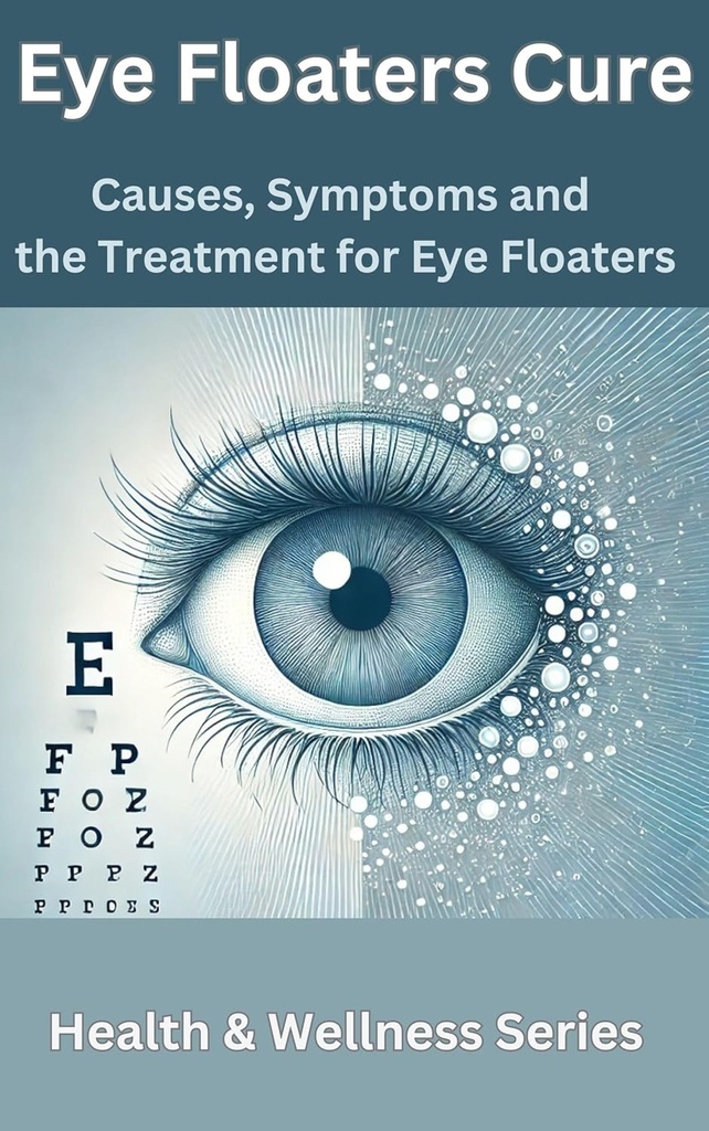 Carga de Floaters Oculares: Causas, síntomas y el tratamiento para las inundaciones oculares