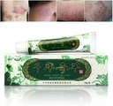 Oversea Thousand-Year Herbal Cream Chinese Herbal Eczema, Psoriasis Creams Dermatitis and Eczema Pruritus Psoriasis JIULIN Ointment
