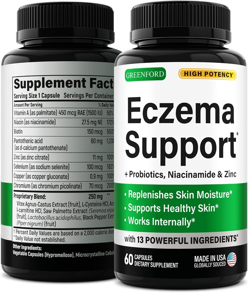 Tratamiento de Eczema Greenford &amp; Asistencia para el Alivio Natural - Hecho en EE.UU. - Vitaminas de la piel " Herbals for Eczema, Acne, Psoriasis, Rosacea Tratamiento con Zinc, Niacinamide " Probióticos - 60 caps