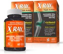 X Ray Dol Triple Acción Conjunto Apoyo Suplemento con Glucosamina 1500mg, Condroitina 800mg, MSM 750mg y 5X Vitamina D para Juntas Saludables, Bones & Cartilage - 60 Cuenta por Botella - 2 Pack