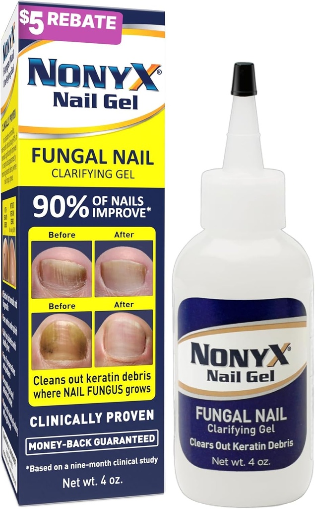 NONYX Fungal Nail Clarifying Gel ← Clínicamente Provenido para Discolored, Thick, Brittle, Yellow, Lifted, y otros signos de Fungus-Damaged Toenails