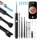 Loyker X6 Ear Wax Removal Tool Camera, Ear Cleaner with Camera, FSA - HSA Store Eligible, 1080P Ear Camera con 6LED Light for Ear/Nose/Throat/Tonsil Stone Examination, Black