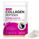 Multi Collagen Peptides Powder | Types I, II, III, V, X | 16 Oz (41 Servings) Hydrolyzed Collagen Peptides | Supports Healthy Skin, Joints, Hair, and Nails | Unflavored & Dissolves Easily
