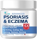 Bio-MD Psoriasis Eczema Cream, Eczema Cream for Adults, Extra Strength Control Reoccurrence, Aliviar Symptom of Resistant, Effective for Seborrheic Dermatitis, Folliculitis Treatment