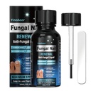 Tratamiento Toenail Fungus, Tratamiento Nail Fungus para Toenail, Reparación de uñas Solución, Fingernails Renovación Líquido Para Daños " Discoloración Nail, Tratamiento de hongos de uñas, de forma segura y gentil - 30ML (1 FLOZ)
